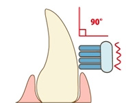 スクラッビング法